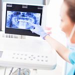 Dentist pointing at a dental X-ray image on a computer screen.