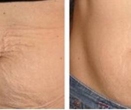 Bauch