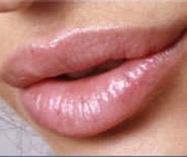 Dr.Juchheim Kosmetik VOLUME 4 LIPS 15ml