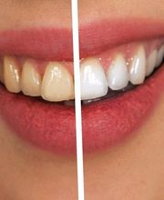 Zahnaufheller24.de Logo