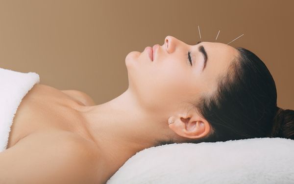 Akupunktur in der Traditionellen Chinesischen Medizin