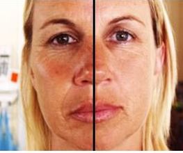 Gesicht