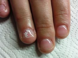 Nahaufnahme von zwei Fingern auf einer Serviette, einer mit weißem Blumenmuster auf dem Nagel.