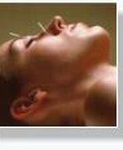 Akupunktur und Meridiane