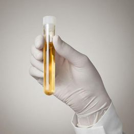 Gloved hand holding a test tube with yellow liquid against a neutral background.