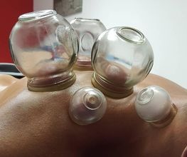 Terapia de ventosas en la espalda de una persona, usando frascos de vidrio.
