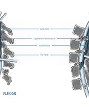 Proben | Extension und Flexion des Nackens