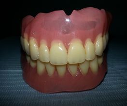 Dentiere complete, superiori e inferiori, su sfondo scuro.