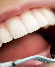 Boca abierta mostrando dientes blancos y espejo dental reflejando encías saludables.