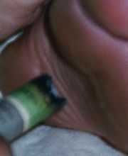 Nahaufnahme einer Fußsohle, die mit einem brennenden Gegenstand berührt wird.