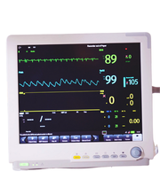 Monitor medico con misurazioni vitali in corso: frequenza cardiaca e ossigenazione del sangue.