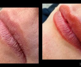 Vóór en na vergelijking van lippen. Links natuurlijke lipkleur, rechts met rode lipstick.
