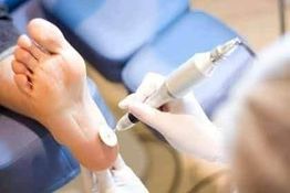 Persona recibe tratamiento podológico en la planta del pie con herramienta eléctrica.