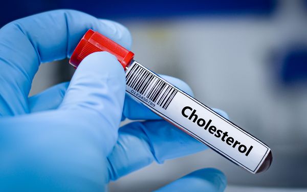 Entnommene Blutprobe zur Kontrolle des Cholesterinspiegels.