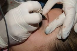 Mikropigmentierung wird auf einer Augenbraue mit Handschuhen und Präzisionsgerät durchgeführt.