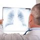 Doctor examining a chest X-ray against a light.