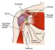 Diagram of shoulder anatomy showing muscles, tendons, and bones like scapula and humerus.